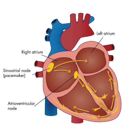 اختلال عملکرد گره سینوسی و کاشت ضربان ساز دائمی مرتبط پس از جراحی‌های بزرگ قلب، مرور سیستماتیک و متاآنالیز